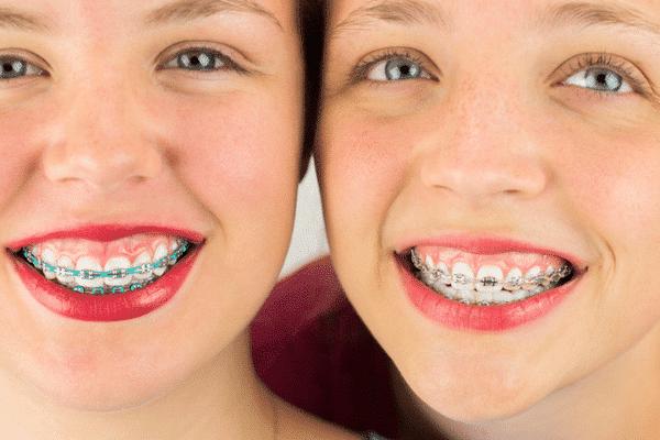 Braces Smile & Co. Orthodontics in Glen Mills and Chester Springs, PA